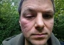 В Тульской области избили кандидата КПРФ Юрия Корецкого